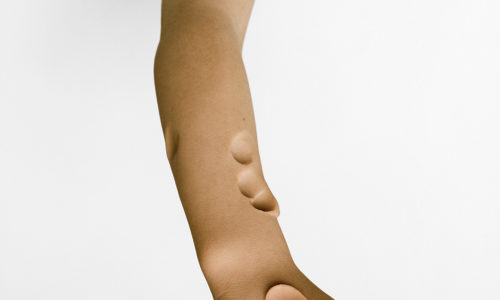 Show Me Your wound  – September 20, 2018 to August 25, 2019